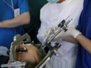 «Операция без операции» на головном мозге проведена в медцентре Рамбам