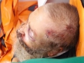 Rabbi Brutally Beaten in Zhitomir, Ukraine: motive for the attack remains unknown
