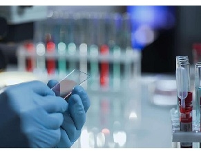 Израиль создаст национальную лабораторию для изучения Covid-19 и будущих вирусов, представляющих угрозу для жизни