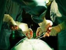 Израильтяне учат казахов кардиохирургии